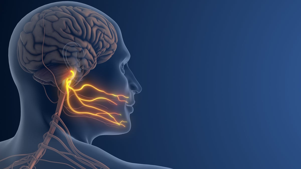 Trigeminal neuralgia facial nerve pain anatomy illustration showing the trigeminal nerve pathways causing sharp facial pain