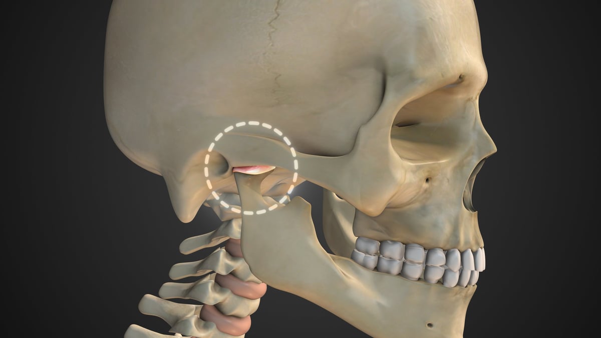 Patient experiencing jaw pain from temporomandibular joint (TMJ) disorder at Texas Nerve and Spine in Sugar Land TX